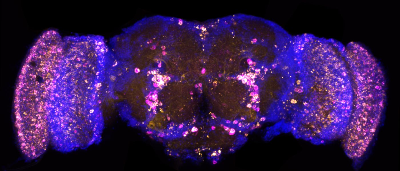 Fluorescent image of a fly's brain