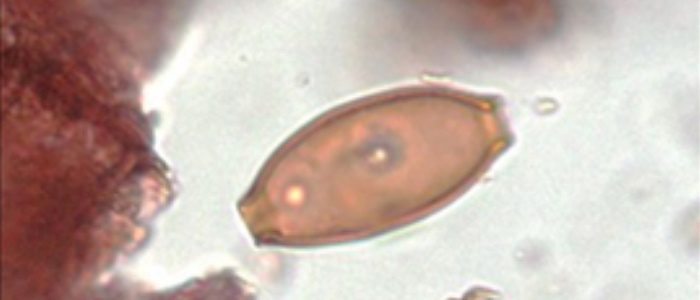 Trichuris (whipworm) egg from Lough Yoan South core. Photo: Brown et al. 2022.