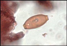 Trichuris (whipworm) egg from Lough Yoan South core. Photo: Brown et al. 2022. 