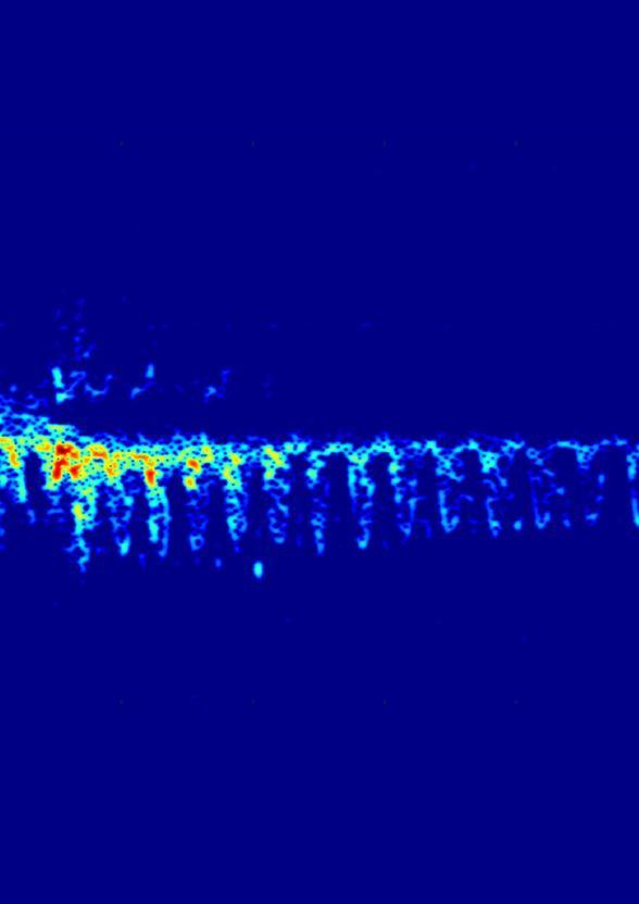 micro-Doppler spectrogram