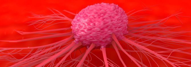 An illustration depicting a cancer cell attached to tissue within the body