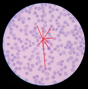 malaria450b