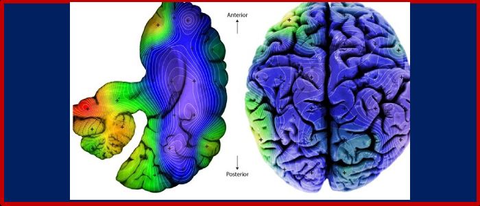Image for Magnetism and the Brain: Pollution, particles and Alzheimer’s disease